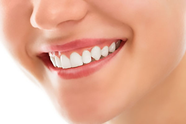 Can An In Office Teeth Whitening Help With Stains?