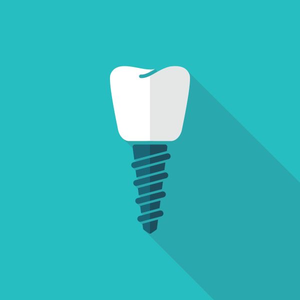 Dental Implant Misconceptions