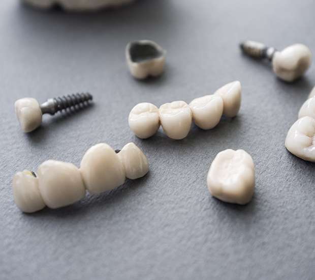 Tucson The Difference Between Dental Implants and Mini Dental Implants